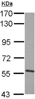 Western blot - Anti-Nectin-4 antibody (AB155692)