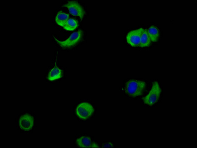 Immunocytochemistry/ Immunofluorescence - Anti-Nectin-4 antibody (AB235897)