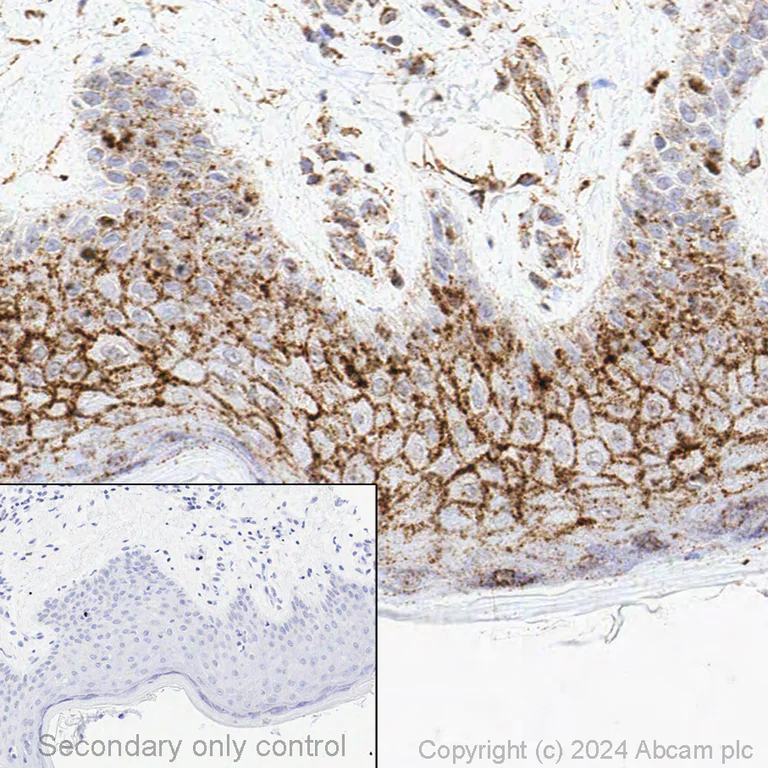 Immunohistochemistry (Formalin/PFA-fixed paraffin-embedded sections) - Anti-Nectin-4 antibody [EPR15613-68] (AB192033)