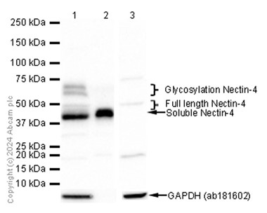 Western blot - Anti-Nectin-4 antibody [EPR15613-68] (AB192033)