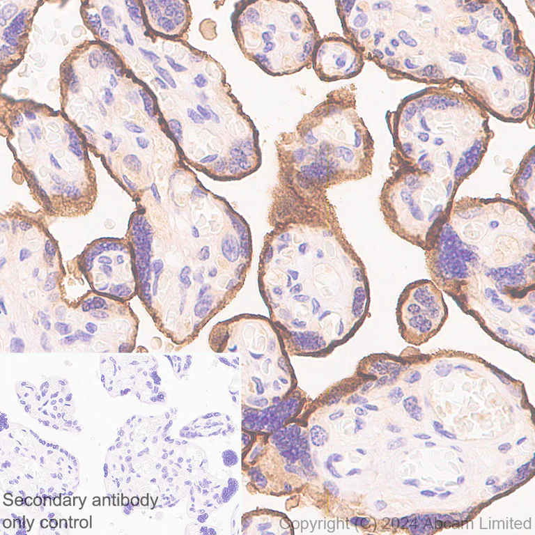 Immunohistochemistry (Formalin/PFA-fixed paraffin-embedded sections) - Anti-Nectin-4 antibody [RM1257] (AB322927)