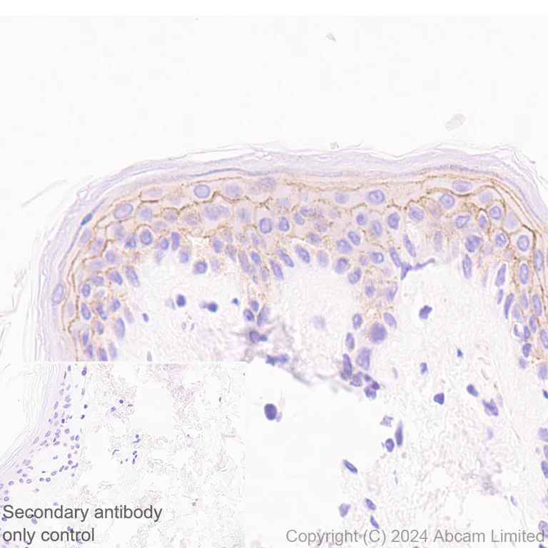Immunohistochemistry (Formalin/PFA-fixed paraffin-embedded sections) - Anti-Nectin-4 antibody [RM1257] (AB322927)