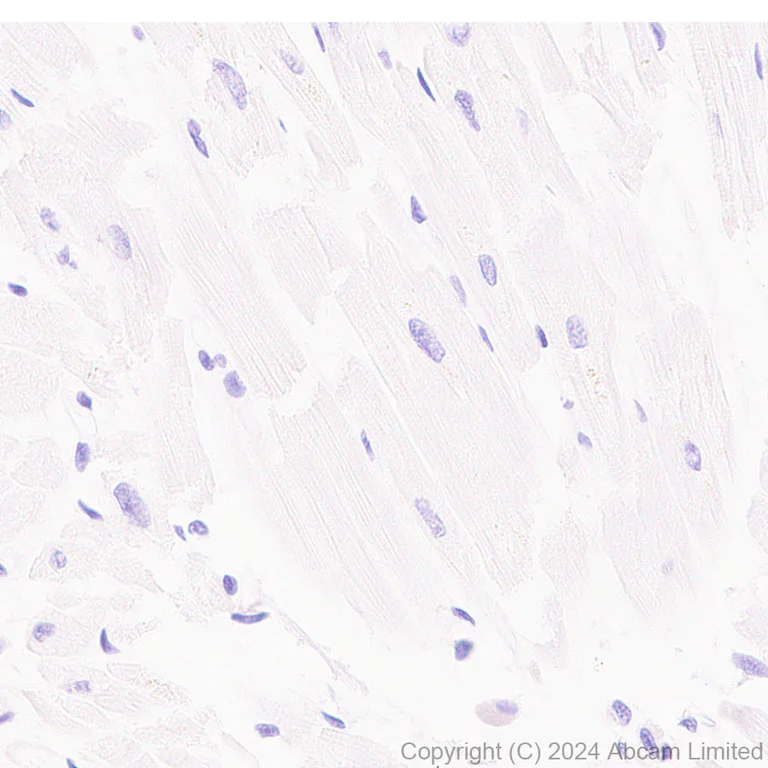 Immunohistochemistry (Formalin/PFA-fixed paraffin-embedded sections) - Anti-Nectin-4 antibody [RM1257] (AB322927)