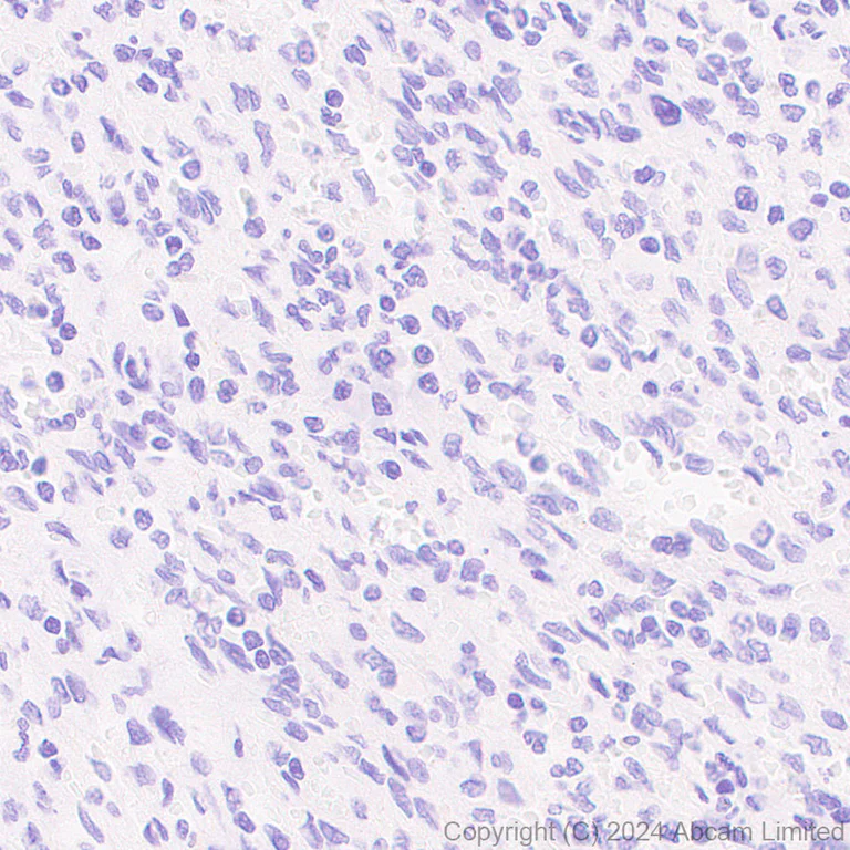 Immunohistochemistry (Formalin/PFA-fixed paraffin-embedded sections) - Anti-Nectin-4 antibody [RM1257] (AB322927)