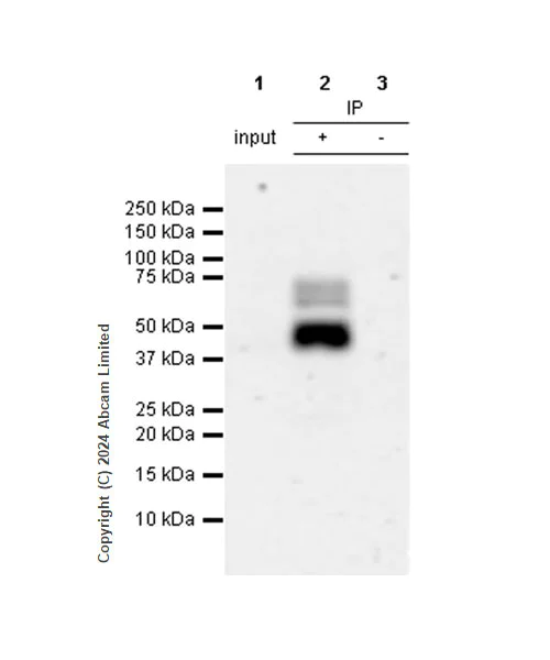 Immunoprecipitation - Anti-Nectin-4 antibody [RM1257] (AB322927)