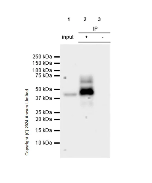 Immunoprecipitation - Anti-Nectin-4 antibody [RM1257] (AB322927)