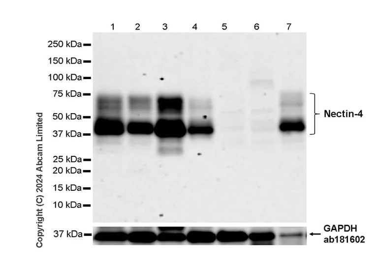 Western blot - Anti-Nectin-4 antibody [RM1257] (AB322927)