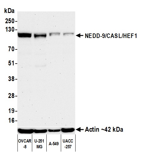 Western blot - Anti-NEDD-9/CASL/HEF1 antibody [BLR248L] - BSA free (AB314111), expandable thumbnail