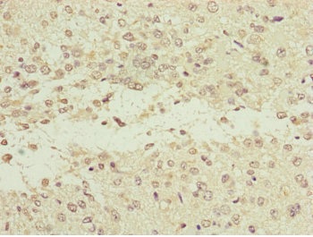 Immunohistochemistry (Formalin/PFA-fixed paraffin-embedded sections) - Anti-NEDD1 antibody (AB230201)