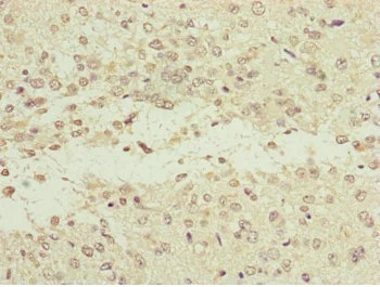 Immunohistochemistry (Formalin/PFA-fixed paraffin-embedded sections) - Anti-NEDD1 antibody (AB230201)