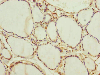 Immunohistochemistry (Formalin/PFA-fixed paraffin-embedded sections) - Anti-NEDD1 antibody (AB230254)