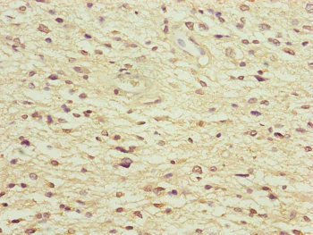 Immunohistochemistry (Formalin/PFA-fixed paraffin-embedded sections) - Anti-NEDD1 antibody (AB230254)