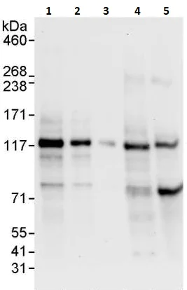 Western blot - Anti-NEDD4-2 antibody (AB240753)