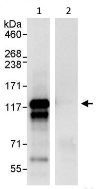 Immunoprecipitation - Anti-NEDD4-2 antibody (AB245522)