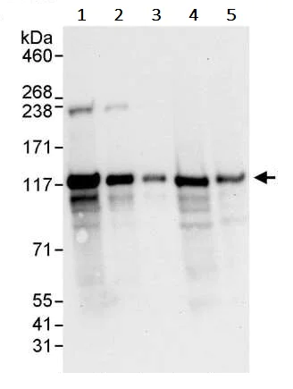 Western blot - Anti-NEDD4-2 antibody (AB245522)