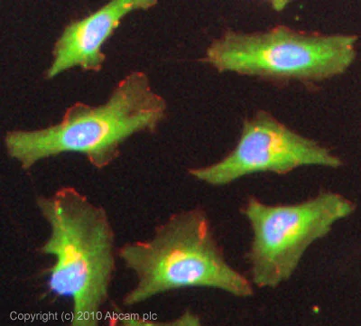 Immunocytochemistry/ Immunofluorescence - Anti-NEDD4-2 antibody (AB46521)