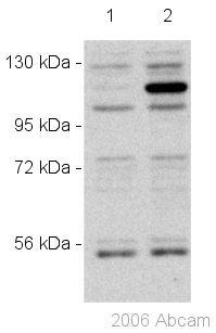 Western blot - Anti-NEDD4-2 antibody (AB46521)