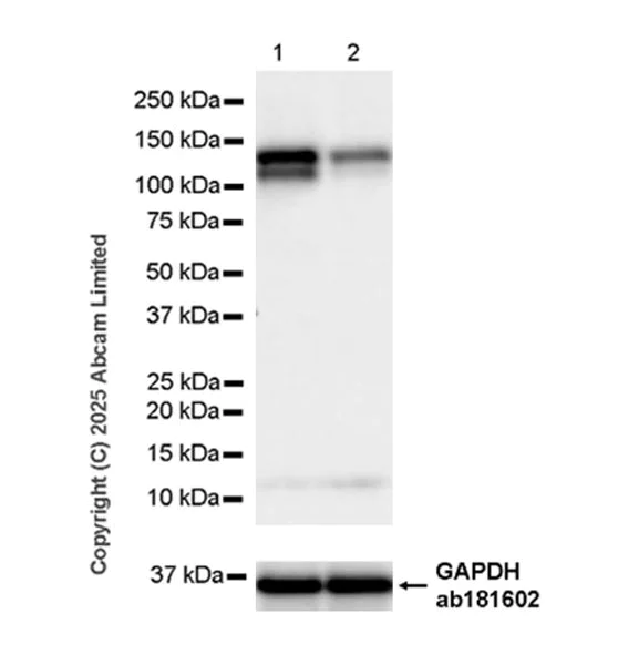 Western blot - Anti-NEDD4-2 antibody [EPR29028-16] (AB324872)