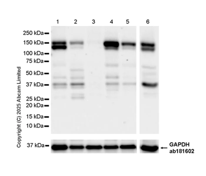 Western blot - Anti-NEDD4-2 antibody [EPR29028-16] (AB324872)