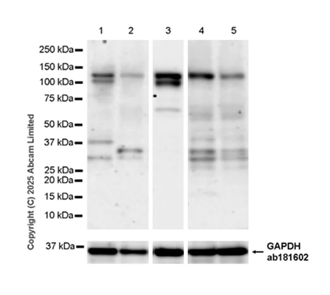 Western blot - Anti-NEDD4-2 antibody [EPR29028-16] (AB324872)