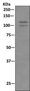 Immunoprecipitation - Anti-NEDD4-2 (phospho S448) antibody [EPR8269(2)] (AB168349)