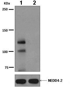 Western blot - Anti-NEDD4-2 (phospho S448) antibody [EPR8269(2)] (AB168349)