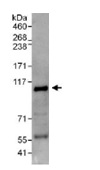 Immunoprecipitation - Anti-NEDD4 antibody (AB117826)