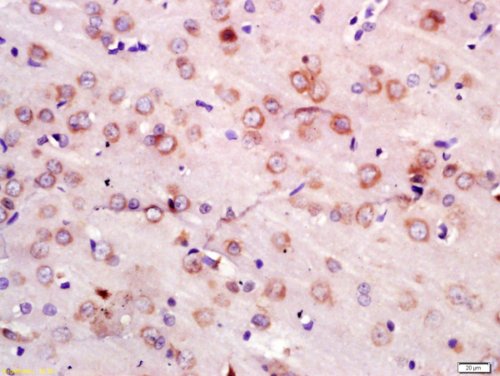 Immunohistochemistry (Formalin/PFA-fixed paraffin-embedded sections) - Anti-NEDD4 antibody (AB217948)
