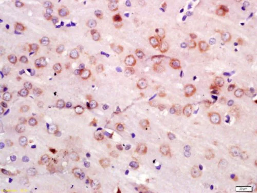 Immunohistochemistry (Formalin/PFA-fixed paraffin-embedded sections) - Anti-NEDD4 antibody (AB217948)