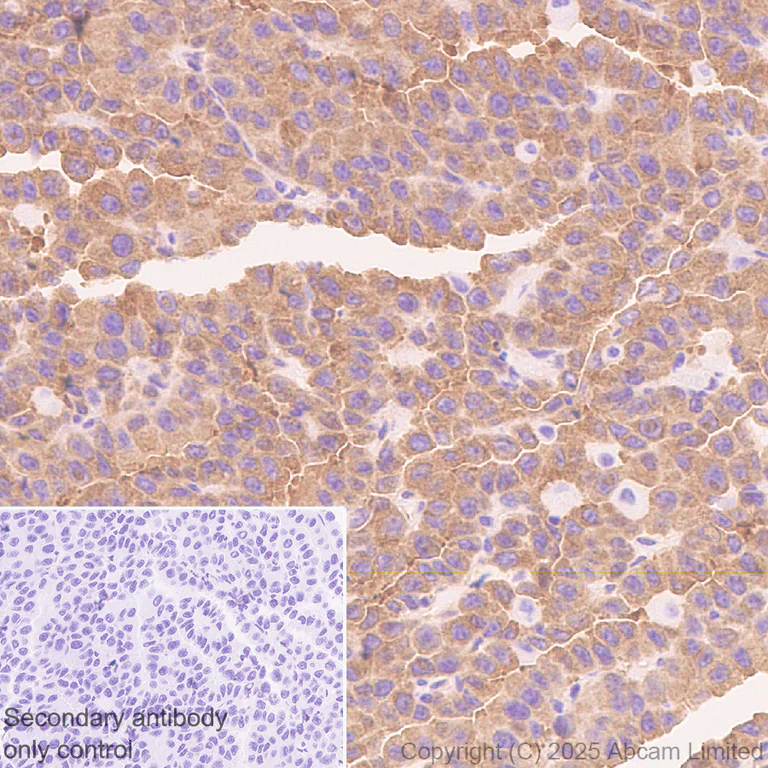 Immunohistochemistry (Formalin/PFA-fixed paraffin-embedded sections) - Anti-NEDD4 antibody [EPR30127-570] (AB324563)