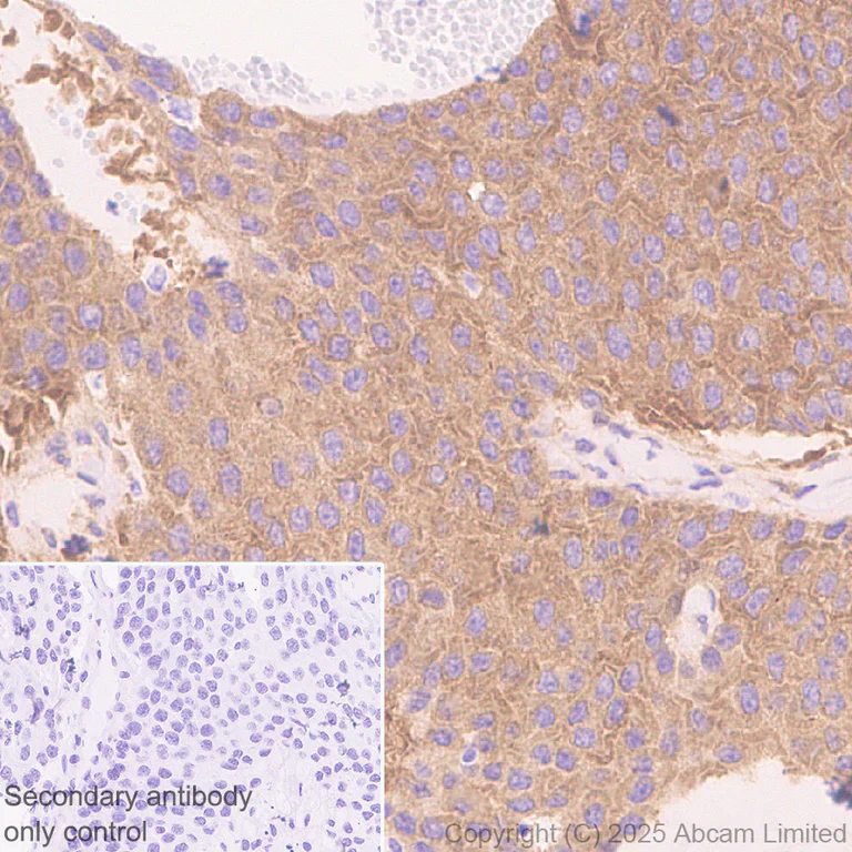 Immunohistochemistry (Formalin/PFA-fixed paraffin-embedded sections) - Anti-NEDD4 antibody [EPR30127-570] (AB324563)