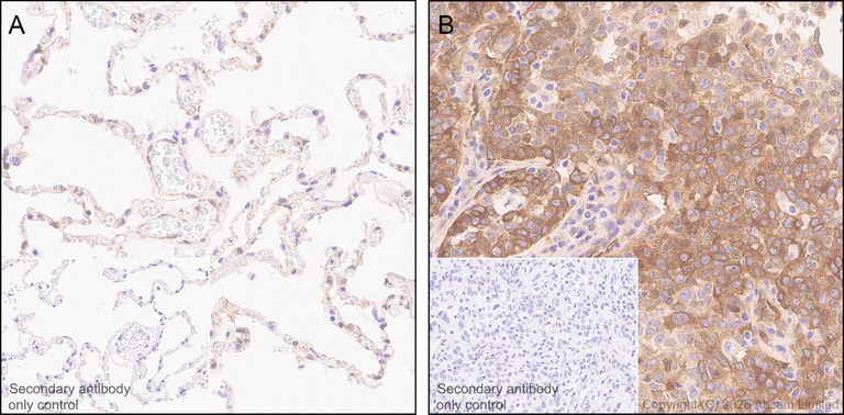 Immunohistochemistry (Formalin/PFA-fixed paraffin-embedded sections) - Anti-NEDD4 antibody [EPR30127-570] - BSA and Azide free (AB326593)