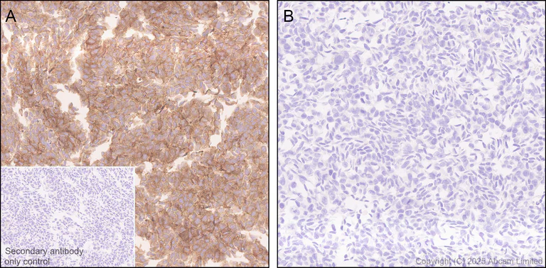 Immunohistochemistry (Formalin/PFA-fixed paraffin-embedded sections) - Anti-NEDD4 antibody [EPR30127-570] - BSA and Azide free (AB326593)