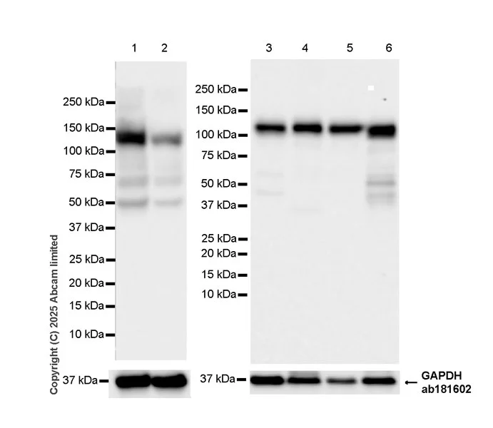 Western blot - Anti-NEDD4 antibody [EPR30127-570] - BSA and Azide free (AB326593)
