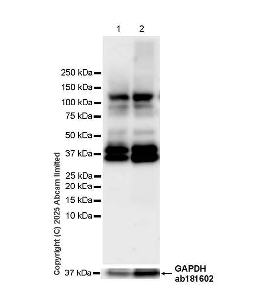 Western blot - Anti-NEDD4 antibody [EPR30127-570] - BSA and Azide free (AB326593)