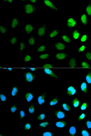 Immunocytochemistry/ Immunofluorescence - Anti-NEDD8 antibody (AB194582)