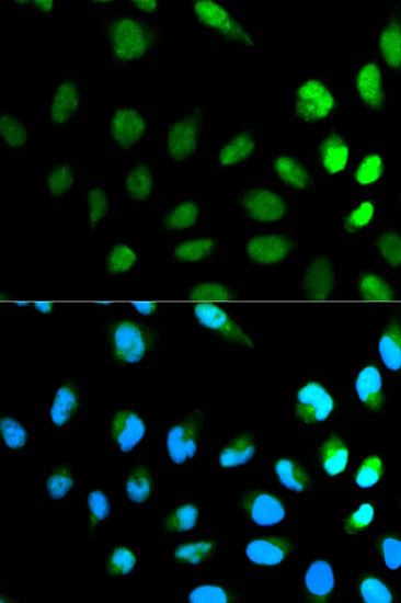Immunocytochemistry/ Immunofluorescence - Anti-NEDD8 antibody (AB194582)