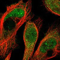 Immunocytochemistry/ Immunofluorescence - Anti-NEDL1 antibody (AB121264)