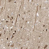Immunohistochemistry (Formalin/PFA-fixed paraffin-embedded sections) - Anti-NEDL1 antibody (AB121264)