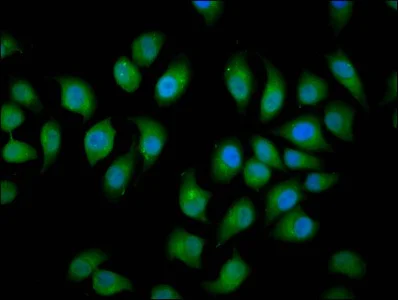 Immunocytochemistry/ Immunofluorescence - Anti-NEDL2 antibody (AB236784)