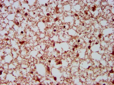 Immunohistochemistry (Formalin/PFA-fixed paraffin-embedded sections) - Anti-NEDL2 antibody (AB236784)