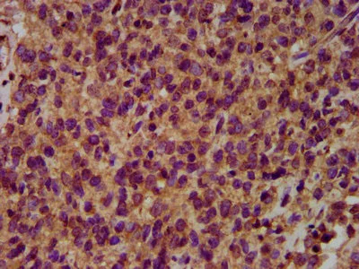 Immunohistochemistry (Formalin/PFA-fixed paraffin-embedded sections) - Anti-NEDL2 antibody (AB236784)