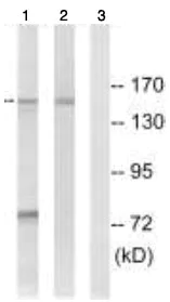 Western blot - Anti-NEDL2 antibody (AB92711)