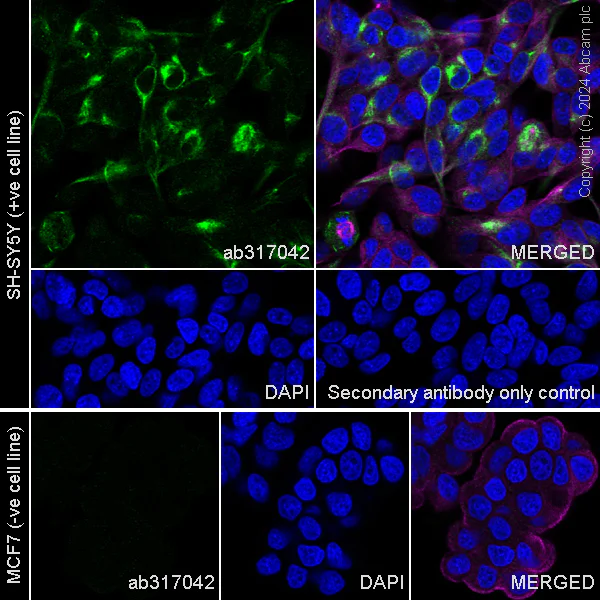 Immunocytochemistry/ Immunofluorescence - Anti-NEFH antibody [EPR20020] - Chicken IgY (Chimeric) - BSA and Azide free (AB317043)