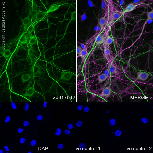 Immunocytochemistry/ Immunofluorescence - Anti-NEFH antibody [EPR20020] - Chicken IgY (Chimeric) - BSA and Azide free (AB317043)