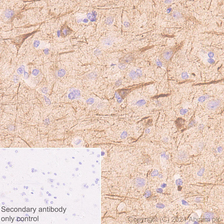 Immunohistochemistry (Formalin/PFA-fixed paraffin-embedded sections) - Anti-NEFH antibody [EPR20020] - Chicken IgY (Chimeric) - BSA and Azide free (AB317043)