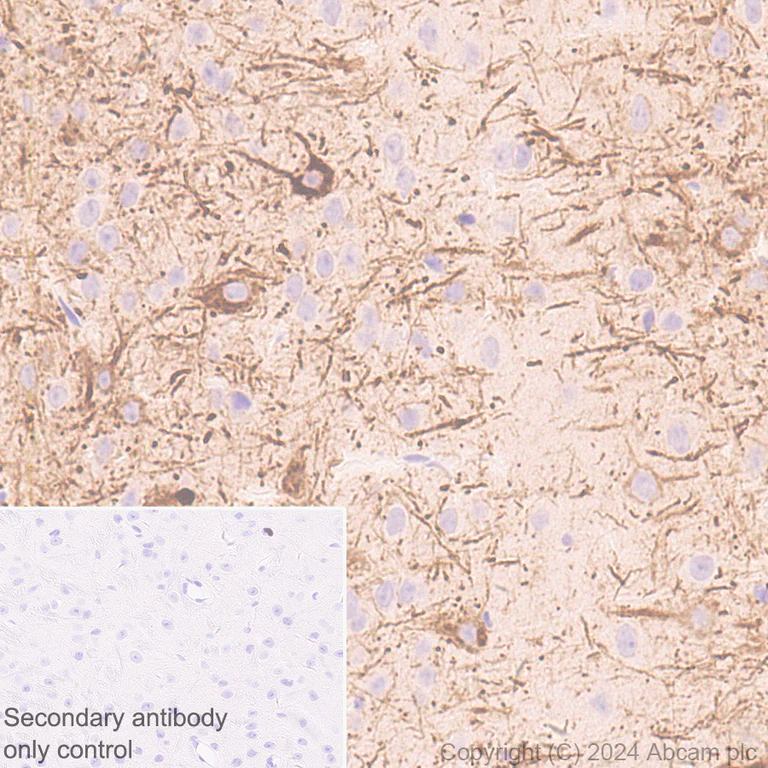 Immunohistochemistry (Formalin/PFA-fixed paraffin-embedded sections) - Anti-NEFH antibody [EPR20020] - Neuronal Marker - Chicken IgY (Chimeric) (AB317042)