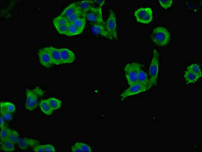Immunocytochemistry/ Immunofluorescence - Anti-NEGR1 antibody (AB237798)