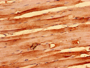 Immunohistochemistry (Formalin/PFA-fixed paraffin-embedded sections) - Anti-NEGR1 antibody (AB237798)