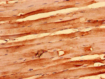 Immunohistochemistry (Formalin/PFA-fixed paraffin-embedded sections) - Anti-NEGR1 antibody (AB237798)